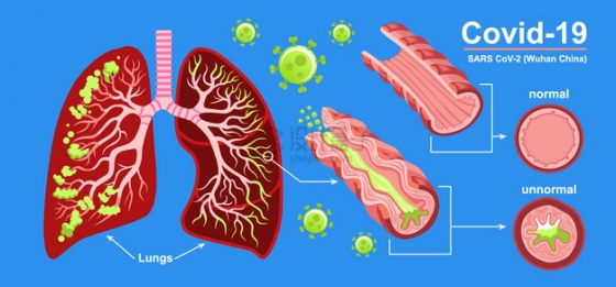 新型冠状病毒对人体肺部的影响插画png图片素材